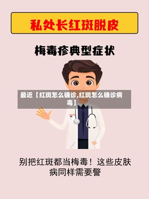 最近【红斑怎么确诊,红斑怎么确诊病毒】