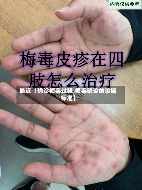 最近【确诊梅毒过程,梅毒确诊的诊断标准】